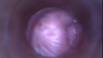 Внутри влагалище